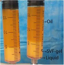 SVF GEL